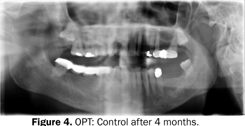 dental-sciences-Control-months