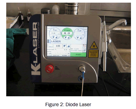 dental-sciences-Diode-Laser