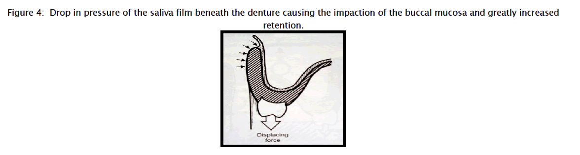 dental-sciences-Drop-pressure-saliva