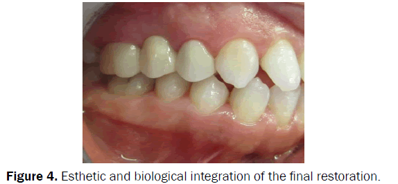 dental-sciences-Esthetic