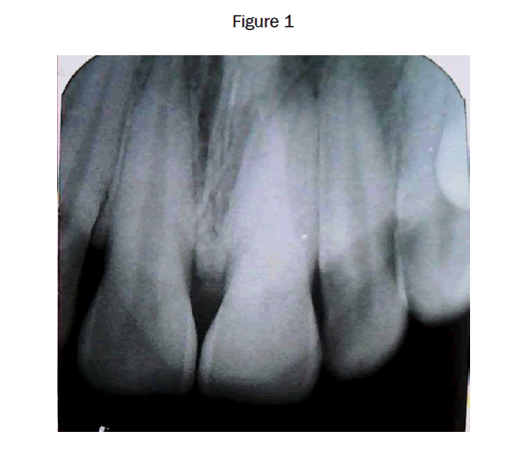 dental-sciences-Figure-1