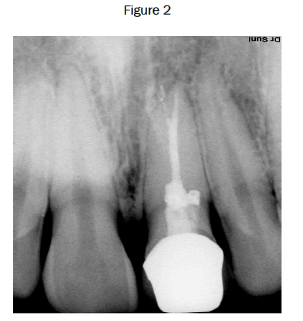 dental-sciences-Figure-2