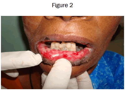 dental-sciences-Figure-2