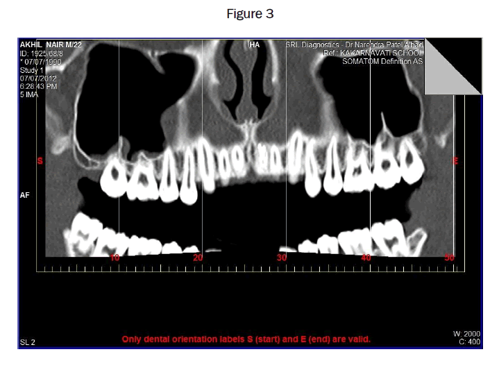 dental-sciences-Figure-3