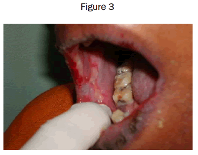 dental-sciences-Figure-3