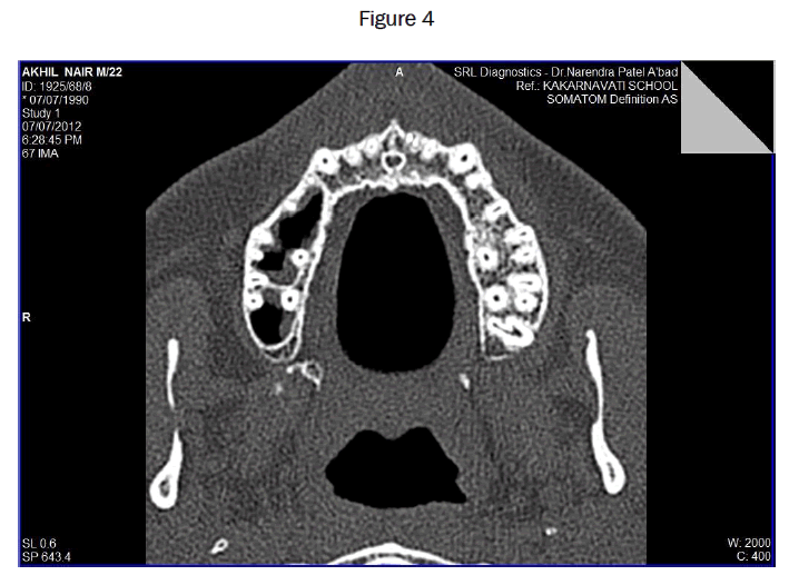 dental-sciences-Figure-4