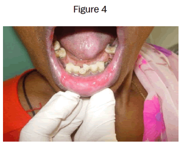 dental-sciences-Figure-4
