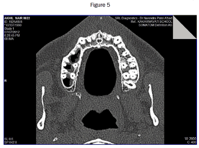 dental-sciences-Figure-5