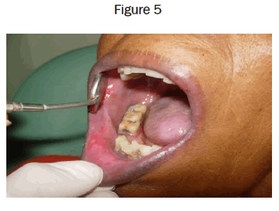 dental-sciences-Figure-5