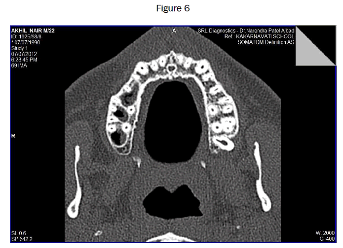 dental-sciences-Figure-6