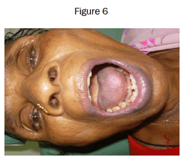 dental-sciences-Figure-6