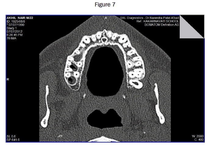 dental-sciences-Figure-7