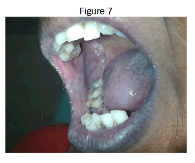 dental-sciences-Figure-7