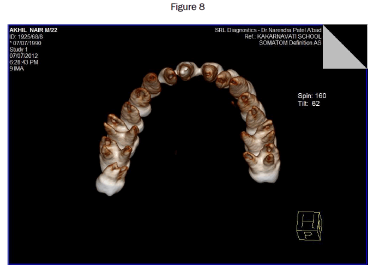 dental-sciences-Figure-8