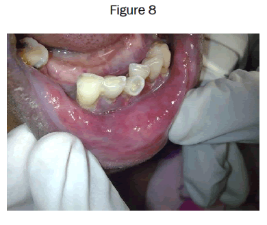 dental-sciences-Figure-8