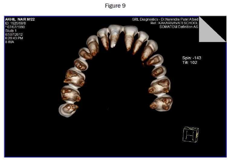 dental-sciences-Figure-9