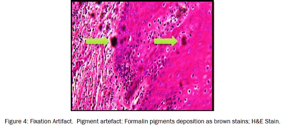 dental-sciences-Fixation