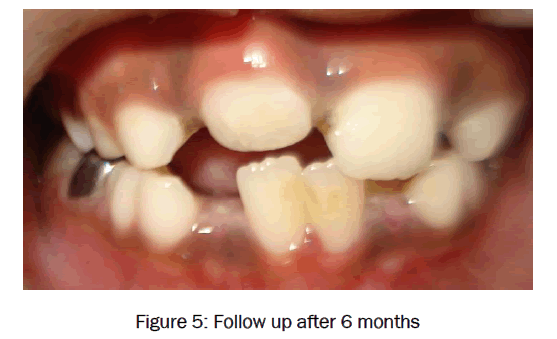 dental-sciences-Follow-up-after-6-months