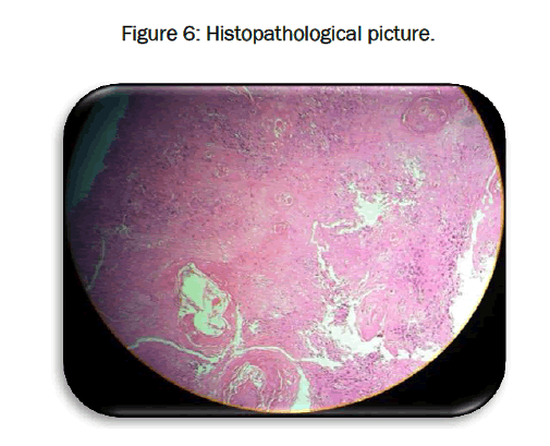 dental-sciences-Histopathological-picture