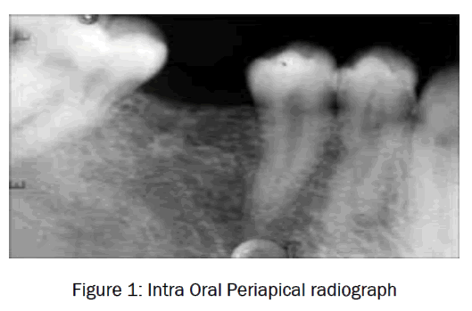 dental-sciences-Intra