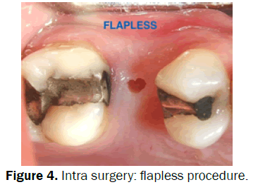 dental-sciences-Intra