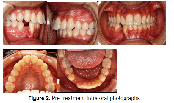 dental-sciences-Intra-oral