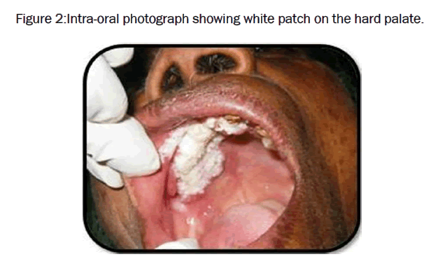 dental-sciences-Intra-oral-photograph