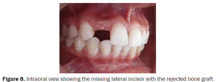 dental-sciences-Intraoral