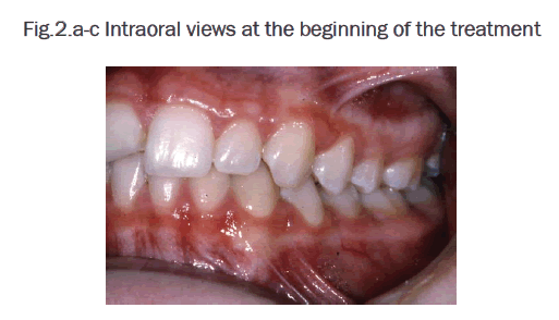 dental-sciences-Intraoral-views-beginning