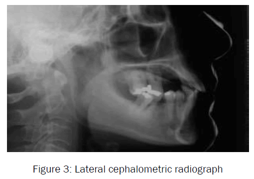 dental-sciences-Lateral