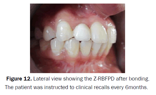 dental-sciences-Lateral