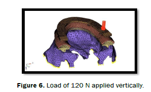 dental-sciences-Load-applied-vertically