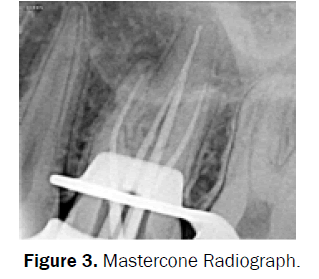 dental-sciences-Mastercone