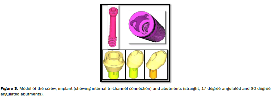 dental-sciences-Model-screw-implant-tri-channel