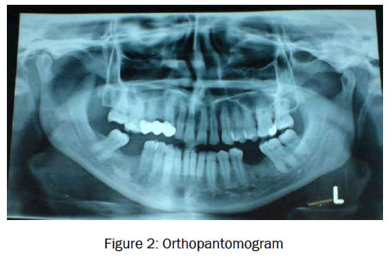 dental-sciences-Orthopantomogram