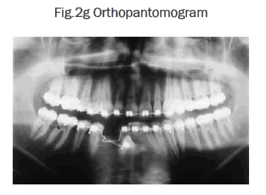 dental-sciences-Orthopantomogram