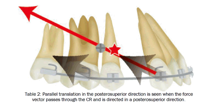 dental-sciences-Parallel-translation-posterosuperior