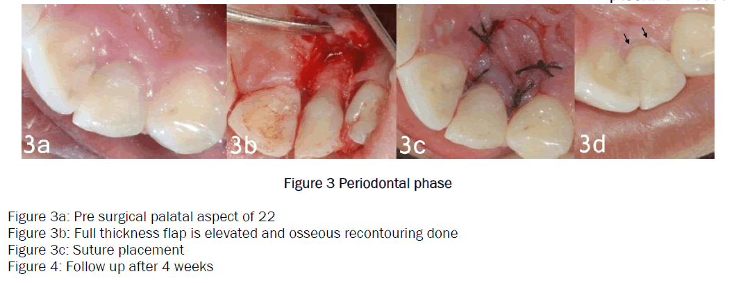 dental-sciences-Periodontal