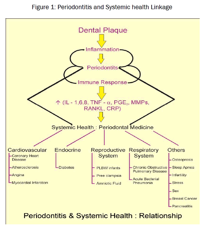 dental-sciences-Periodontitis