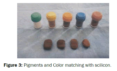 dental-sciences-Pigments-Color