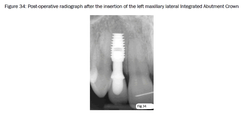 dental-sciences-Post-operative-radiograph