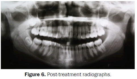 dental-sciences-Post-treatment