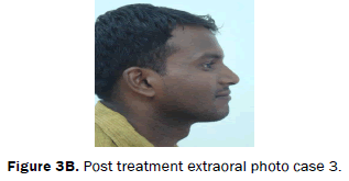 dental-sciences-Post-treatment-extraoral-photo