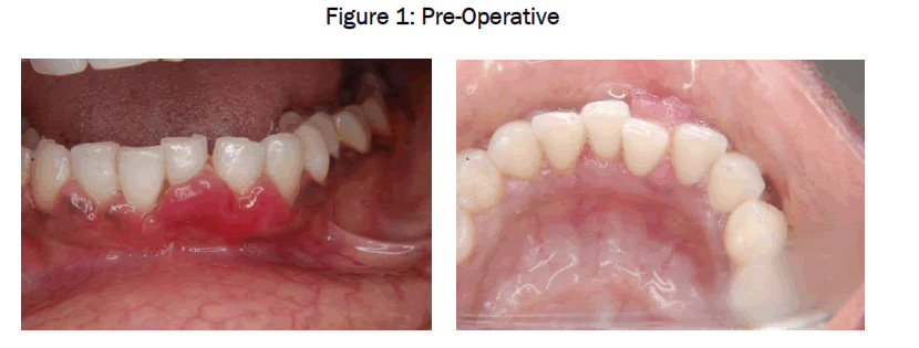 dental-sciences-Pre-Operative