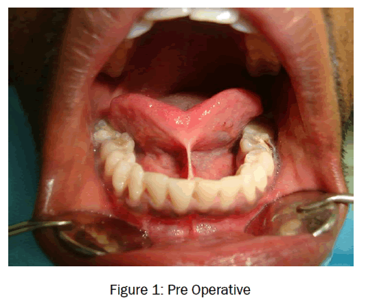 dental-sciences-Pre-Operative