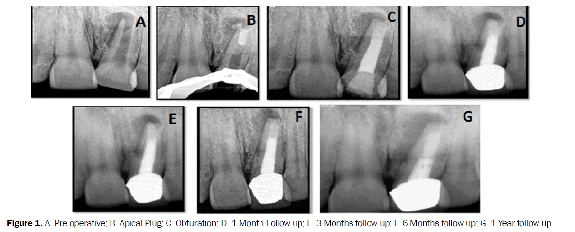 dental-sciences-Pre-operative