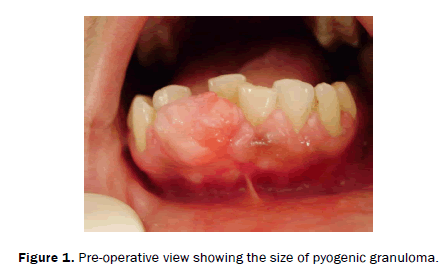 dental-sciences-Pre-operative-size