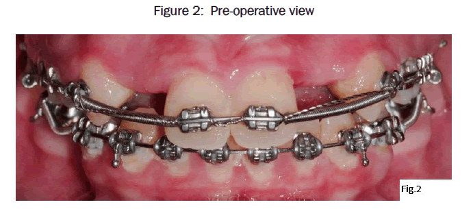 dental-sciences-Pre-operative-view