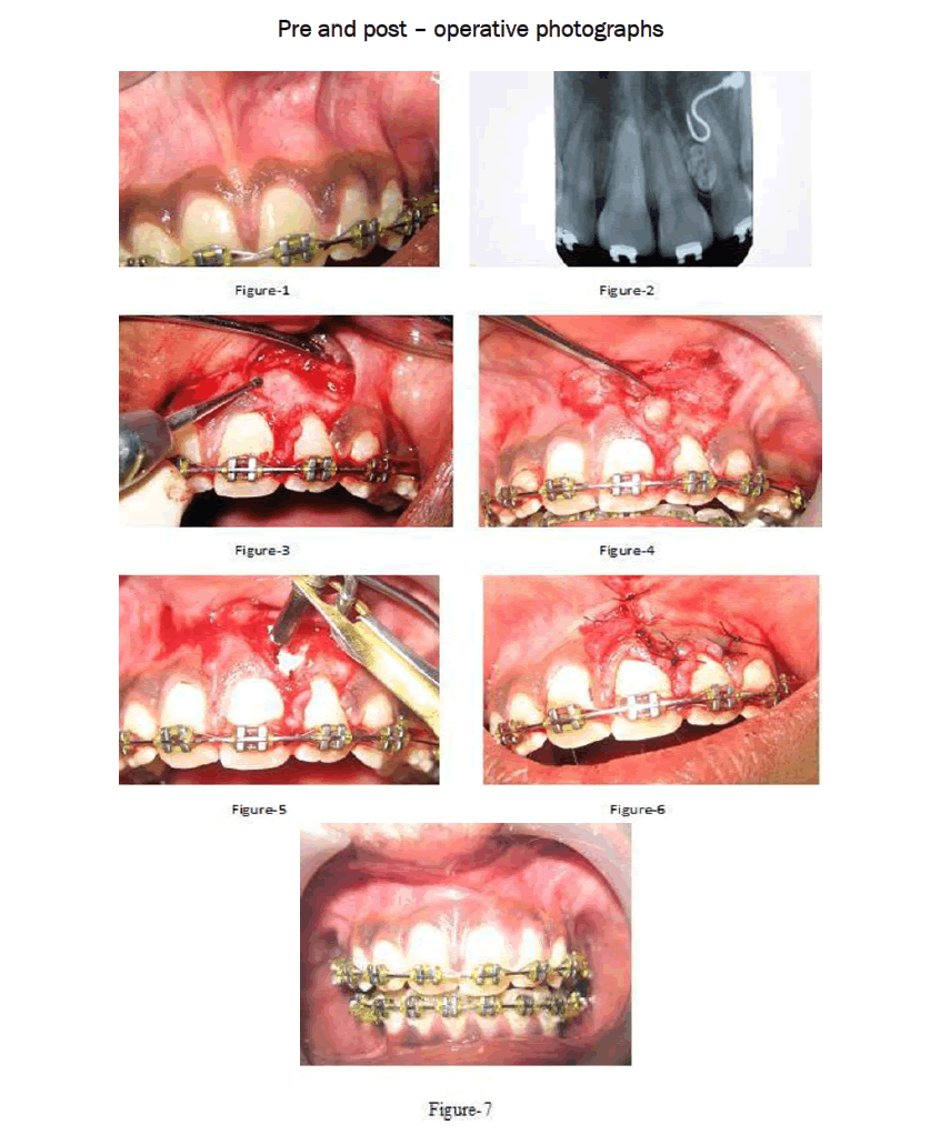 dental-sciences-Pre-post-operative-photographs