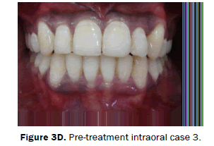 dental-sciences-Pre-treatment-extraoral-photo